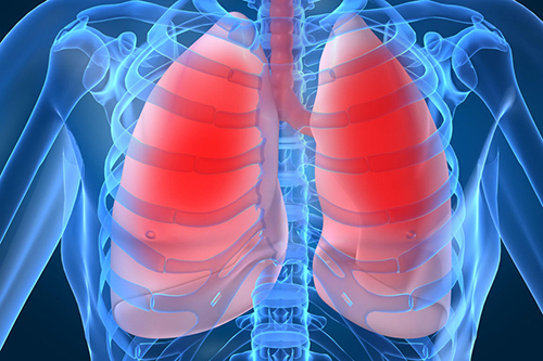 Maladies Respiratoires et Chroniques