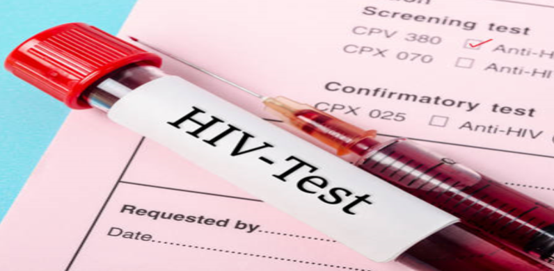 Realisation des tests de dépistage du VIH